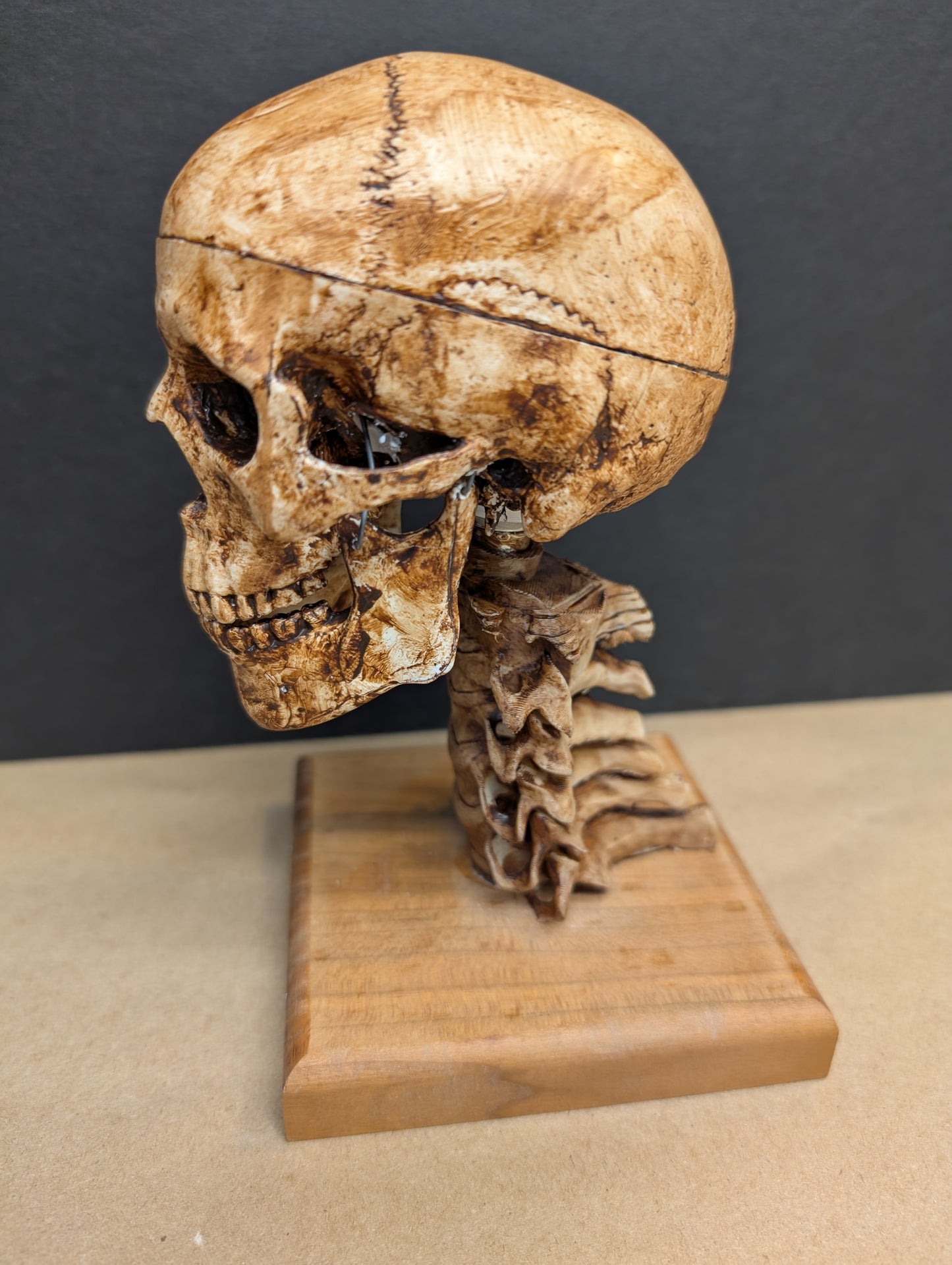 Anatomical Spirit Skull,  Remote-Actuated Jaw